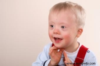 Adoptar a un niño con síndrome de Down 