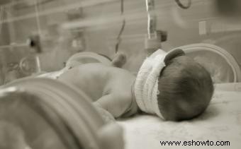 Efectos de la reanimación en bebés prematuros