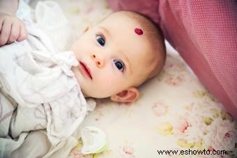 Datos sobre las marcas de nacimiento de fresa en bebés