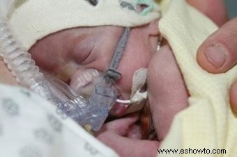 Efectos a largo plazo de la oxigenoterapia en bebés prematuros
