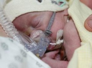 Efectos a Largo Plazo de la Oxigenoterapia en Bebés Prematuros: Beneficios y Riesgos