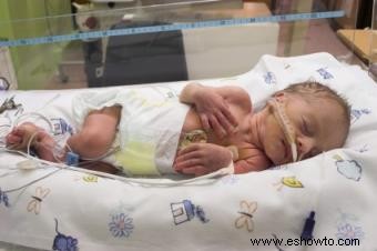 Monitoreo transcutáneo de oxígeno en bebés prematuros