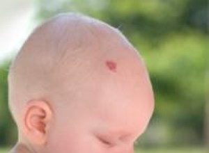 Hemangioma en Bebés: Guía Completa sobre Diagnóstico, Tratamiento y Evolución