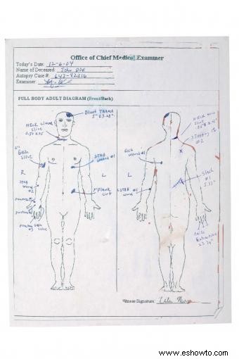 Conceptos básicos del informe de autopsia:una guía fácil de entender