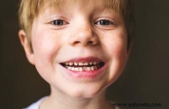 ¿Por qué los niños tienen dientes de más? 