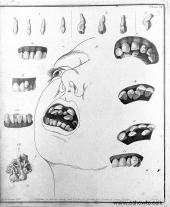 ¿Por qué los niños tienen dientes de más? 