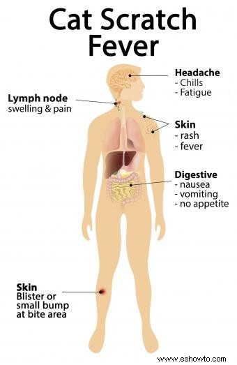 5 síntomas de infección por mordedura de gato que no debe ignorar