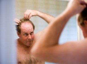 5 Reacciones Típicas de los Hombres al Empezar a Perder el Cabello
