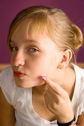 Consejos para el cuidado de la piel para pieles propensas al acné