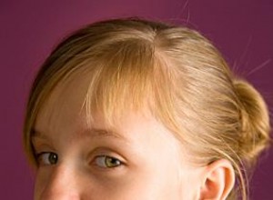 Guía Experta: Consejos para el Cuidado de la Piel Propensa al Acné