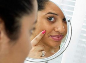 Cómo eliminar las ojeras debajo de los ojos en la piel negra 