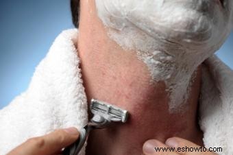 Cómo tratar y prevenir el sarpullido por afeitado