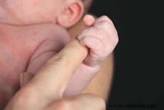 Erupción en el cuello del bebé