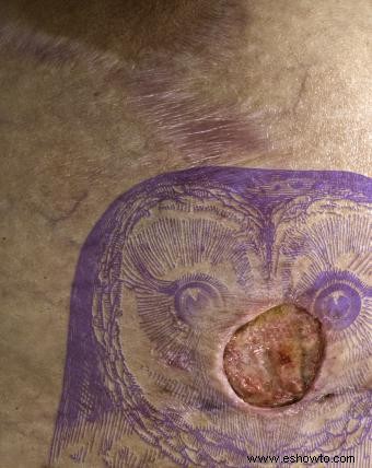 Síntomas de tatuaje infectado