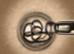 Tratamientos con Células Madre para el Autismo: Avances Científicos y Potencial Terapéutico