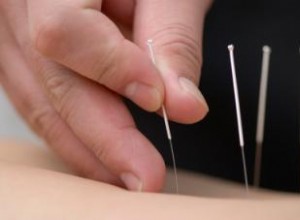 Ayuda de la acupuntura para la enfermedad celíaca