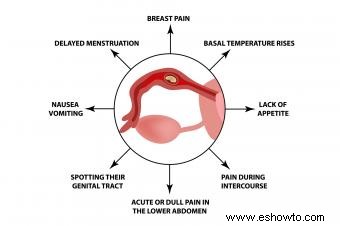 21 señales de advertencia de un embarazo ectópico o tubárico