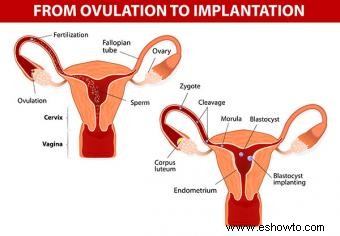 Progesterona baja, infertilidad y aborto espontáneo temprano