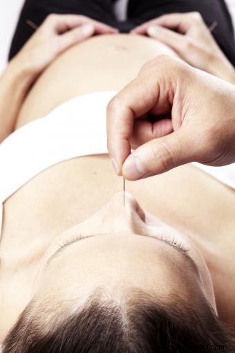 Uso de acupresión y acupuntura durante el parto