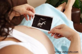 Tamaño fetal y otros desarrollos a las 20 semanas