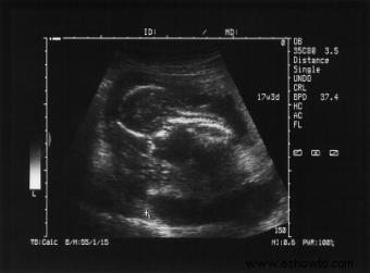 Etapa embrionaria del desarrollo fetal