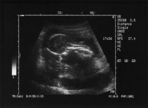 Etapa Embrionaria del Desarrollo Fetal: Guía Completa Semana a Semana