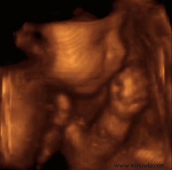 Por qué son tan importantes las ecografías durante el embarazo