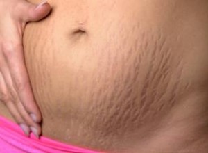 Cuidando su barriga después del embarazo
