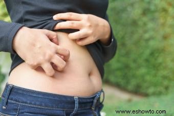 Cuidando su barriga después del embarazo