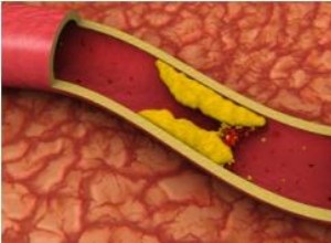 Cómo el estrés eleva los niveles de colesterol: La conexión científica y cómo controlarlo