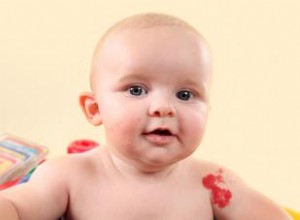 ¿Están relacionadas las marcas de nacimiento y las vidas pasadas? Los investigadores opinan 