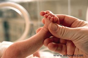 Problemas de bebés prematuros a largo plazo
