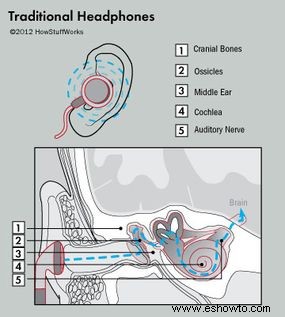 Cómo funcionan los auriculares de conducción ósea 