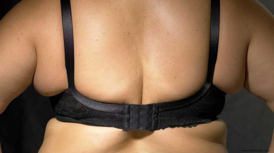 Cómo deshacerse de la grasa de la espalda:usted pregunta, nosotros respondemos 