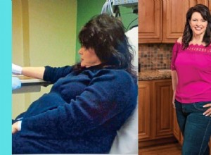 Cómo perdí 105 libras y superé la ansiedad con la dieta cetogénica: la historia real de Lisa Carroll