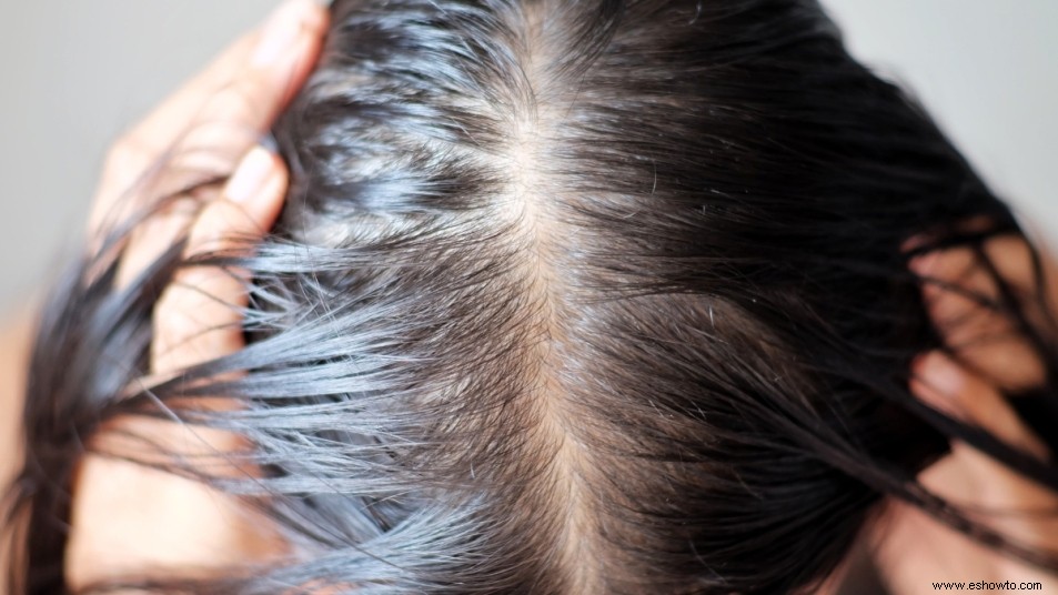 Comer demasiado de este tipo de alimentos puede causar pérdida de cabello 