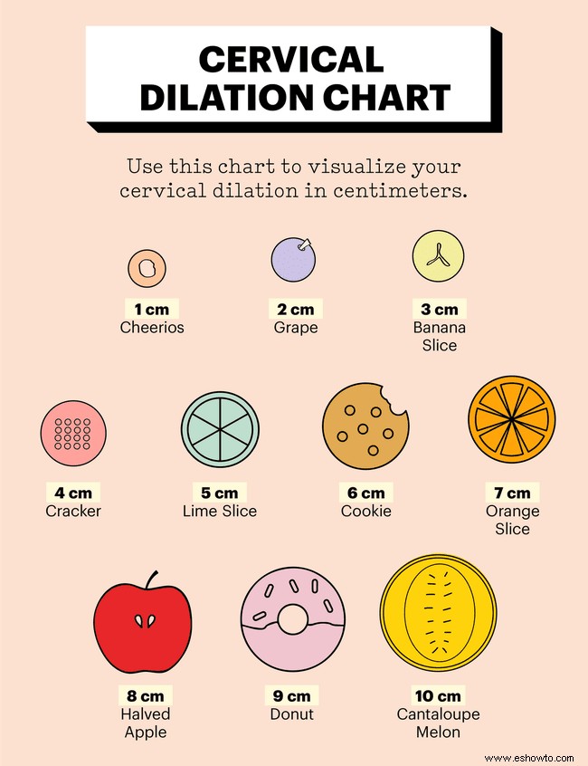 Tabla de dilatación cervical:las etapas del trabajo de parto explicadas en imágenes 