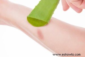 Planta de aloe vera:usos, beneficios y cuidado adecuado de la planta