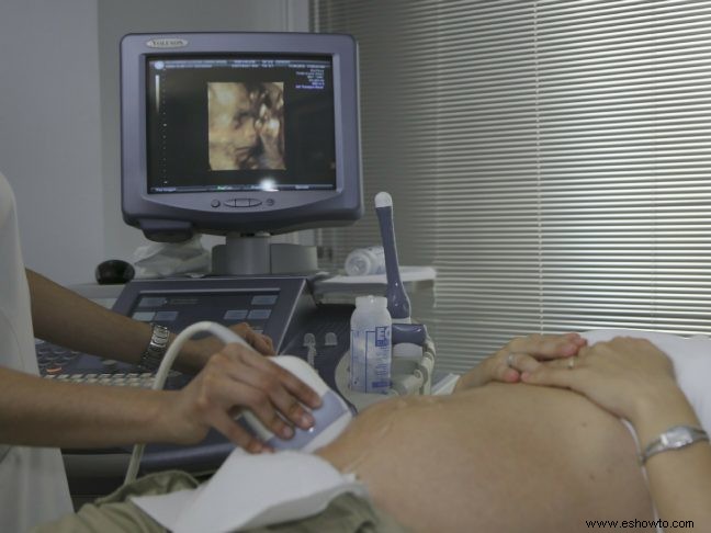 5 preguntas para hacerle a su obstetra durante su visita prenatal inicial